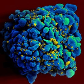 cells-fiery-suicide-in-hiv-provides-hope_1